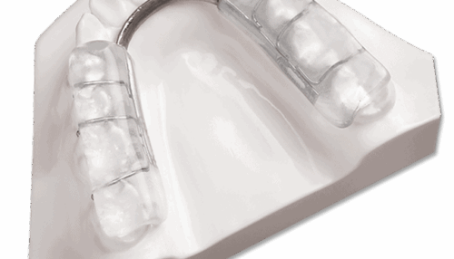 gouttiere de disjonction