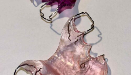 plaque de surélévation